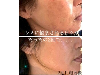 シャイネル(SHYNELL)