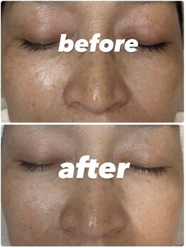 ポーラ ザ ビューティ 堺東店(POLA THE BEAUTY)/