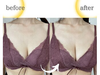 ラジュワード(lajward)/バストケア　before→after