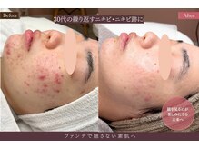 アロマ(AROMA)