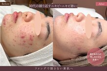 アロマ(AROMA)