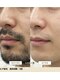 アーユス 健軍店(Ayus)の写真/男性のヒゲ脱毛6,980円!顔全体でこの価格!通常よりも高出力で早く終わる!都度払いで好きな時に通える