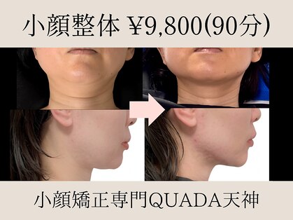 クアダ 天神(QUADA)の写真