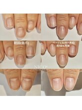 ニコプラス(NICO+)/自爪育成中