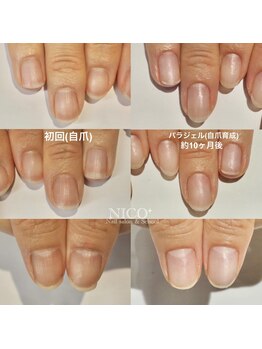 ニコプラス(NICO+)/自爪育成中