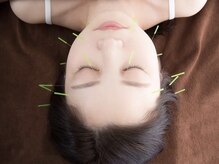 カムカムの雰囲気（【美容鍼/鍼灸/骨格調整】細胞活性・内臓機能がアップ◎小顔施術）