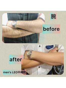 ランドマーク 中崎町(LANDMARK.)/《 腕 》