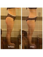 カルナ(carna)/反り腰　1回