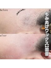 セレネ(Selene)/うなじワックス