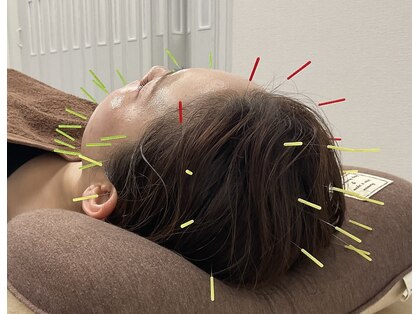 ブロッサム(Blossom)の写真