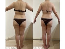 ヴィクシア(VIXIA)/痩身90分