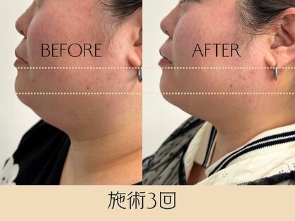ジーニー(genie)の写真
