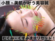 ソラナ(Solana)