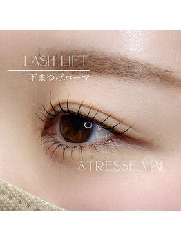トレス(TRESSE)/上下ラッシュリフト