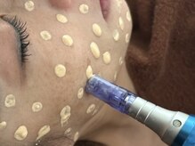 肌のくすみを改善してワントーンアップの明るい肌に！