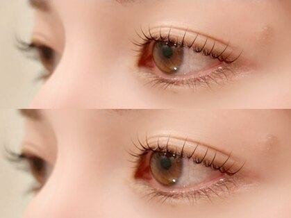 シュシュ(chouchou)の写真