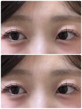 エクラ(ECLAT)/＆ヘルシー【ワンホン】