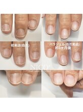 ニコプラス(NICO+)/自爪育成中