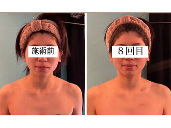 ラポール(RAPPORT)/小顔コルギ＋フェムケア矯正