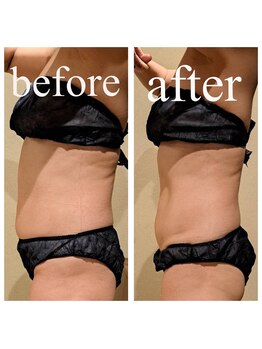 ディス イズ ミー エステティック(This is Me Aesthetic)/本気で痩せたいを全力サポート