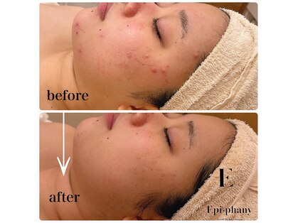 エピファニー(Epi phany Total Beauty Salon)の写真
