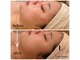 エピファニー(Epi phany Total Beauty Salon)の写真
