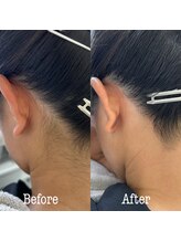 ベリンダ ワックス(BELINDA WAX)/うなじワックス