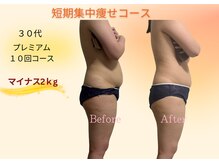 ヨサパーク リボーン(YOSA PARK Reborn)/劇的ビフォーアフター/痩身駒込