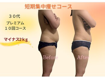 ヨサパーク リボーン(YOSA PARK Reborn)/劇的ビフォーアフター/痩身駒込