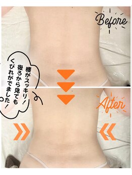 スリモア(SLIMORE)/ビフォーアフター☆背中、腰