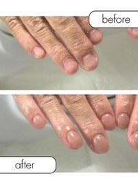 ◆深爪矯正＋自爪風仕上げ◆