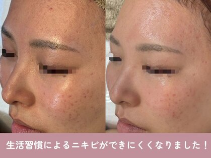 芯美 恵比寿店(shinbi)の写真