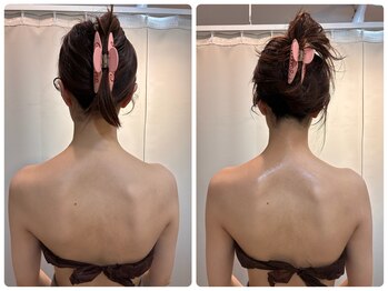 ヨジャラボ(ヨジャLAB)の写真/肩/首こり/重だるさを深部から改善！温め吸引×筋膜リリースで驚くほど軽い体と美姿勢で疲れ知らずの毎日へ