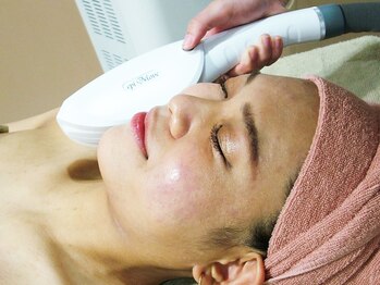 アローナ(Arona)/【お顔脱毛】顔脱毛