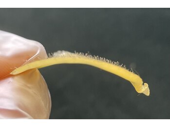 ミーミドットアイ(Mi-mi.i)/お顔にはこんなに産毛が!!