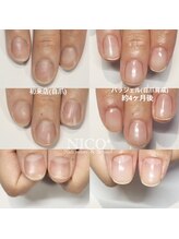 ニコプラス(NICO+)/自爪育成中