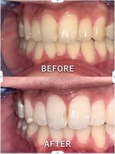 ライトビューティー 池袋店(LightBeauty)/症例写真