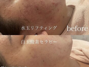 サロンヴェアリー 広尾(salon vary)/花粉や乾燥に速攻潤いチャージ♪