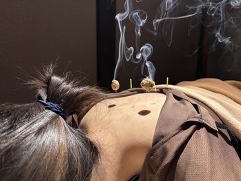 森の鍼灸院 京都下京町家院の写真/【辛い首肩に☆】施術後の身体の軽さに感動♪ほぐすことで老廃物の排出を促進しスッキリリフレッシュ!