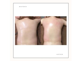 シャルロット(Charlotte)