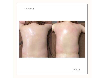 シャルロット(Charlotte)の写真