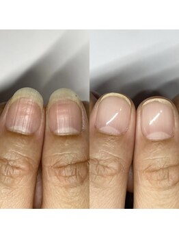 ルジュア(Lujyua)/自爪育成