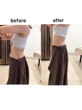 ジョワイユ(Joyeux)/腸の位置でお腹は変わる