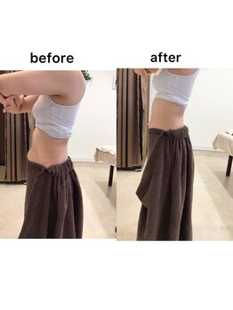 ジョワイユ(Joyeux)/腸の位置でお腹は変わる