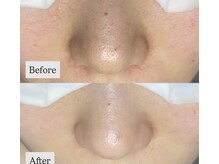 ヨサパーク モナミ 有田店(YOSAPARK monami)の雰囲気（毛穴の黒ずみ、たるみ、開き毛穴などもお任せ下さい。）