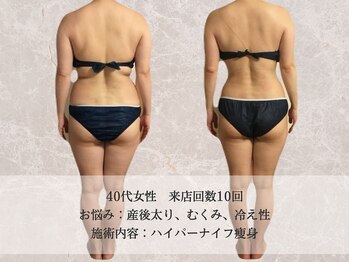 エクストリミティ 国立店(EXTREMITY)/お客様の変化