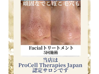 イーサム(EASAM)の写真