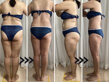 リヘッド(Re.head)の雰囲気（ガチガチ凸凹脂肪を温めほぐします/無理な勧誘ありません/痩身）
