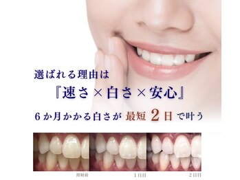 ブリエ 久屋大通店(BRILLER)/最短で理想の白さに
