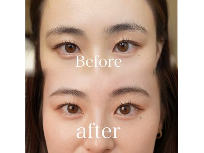 ラシェリ(Lacherie)の写真